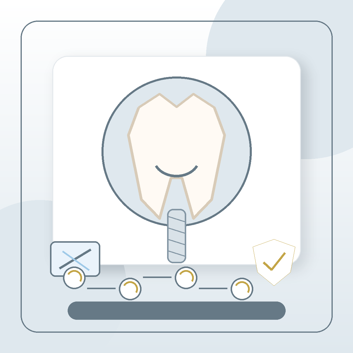 Dental Implants modern dental treatment illustration
