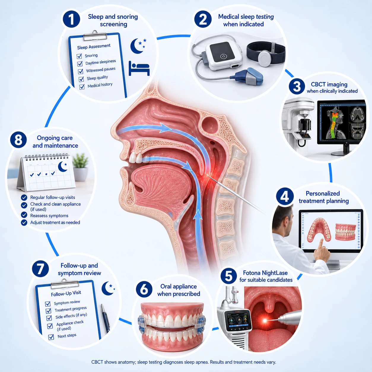 Eight illustrated stages: Sleep and snoring screening; Medical sleep testing when indicated; CBCT imaging when clinically indicated; Personalized treatment planning with your sleep-care team; Fotona NightLase for suitable snoring-treatment candidates; Custom oral appliance when prescribed; Follow-up and symptom review; sleep testing when recommended; Ongoing care and maintenance