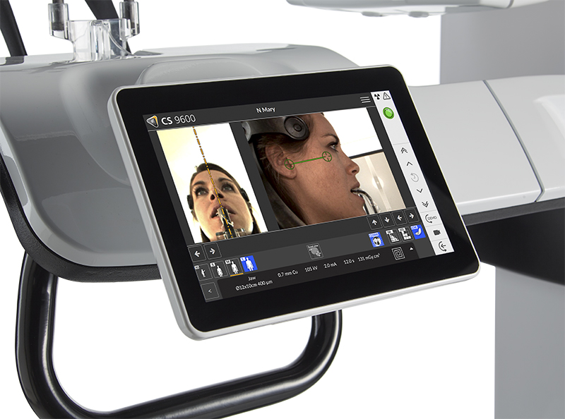 CS 9600 Face Scan